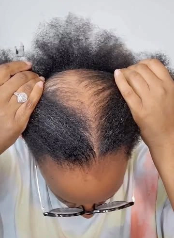 Why is my hair thinning Memphis specialist Kristy Jarrett