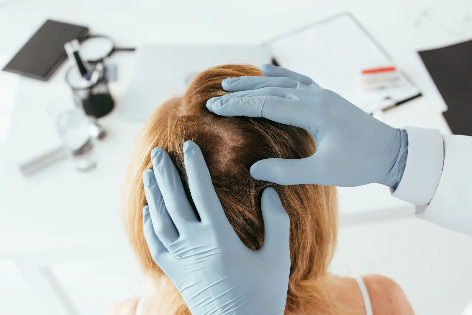 Alopecia Areata Treatment Memphis — GlamorChiQ Memphis TN