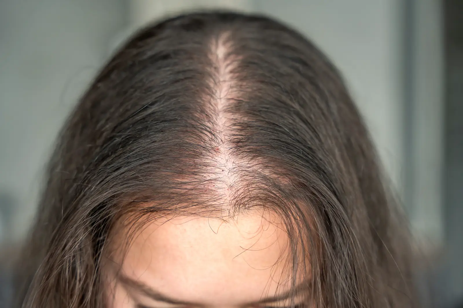 Why Is My Hair Thinning Memphis — GlamorChiQ Memphis TN